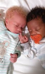 Black and white twins by gabry(f): Mum Of Black And White Twins Says People Don T Believe They Re Her Children World News Mirror Online