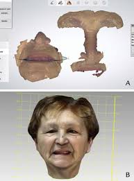 Digital dentures: A protocol based