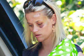 Find great deals on ebay for fear reese witherspoon. Reese Witherspoon Gets Hit Rocket Times