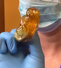 This is the length it typically grows just five to seven days after shaving.there's only one. Best Hair Length For Sugaring Wax Hair Removal In Tucson