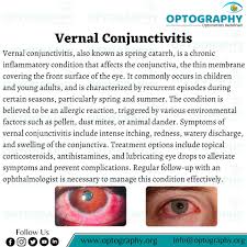 Image result for Vernal Conjunctivitis