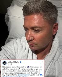 Former Australia cricketer and legend Michael Clarke is suffering from skin  cancer. Wishing him a speedy recovery. 🙏
