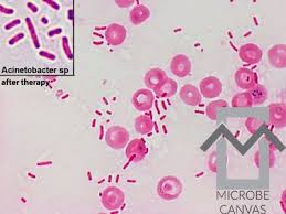 Image result for Striga baumannii