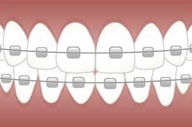 When the time is right, your. Orthodontics Archives The Brace Place