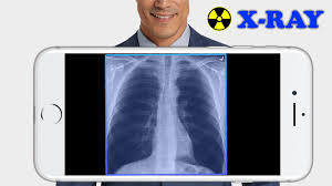 The app is quite plain as it functions as an xray clothes app that removes someone's clothes. X Ray Filter Photo For Android Apk Download