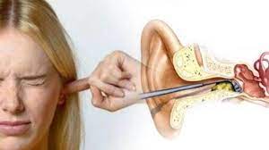 Telinga yang berdengung (juga disebut sebagai tinnitus) setelah mendengar musik bersuara keras sering kali diakibatkan oleh cara menghilangkan telinga berdengung. Jangan Sepelekan Telinga Mendengung Jika Lebih Dari 2 Minggu Bisa Jadi Pertanda Ini Tribun Batam