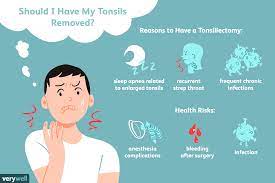 If you need a tonsillectomy and it's medically urgent you can have the procedure completed and just feel out a medical hardship form at the hospital that you plan to have the procedure performed. Tonsillectomy Preparation Recovery Long Term Care