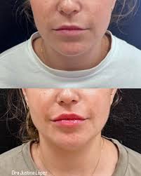 Dra Justina Lopez /medicina (@drajustinalopez) • Instagram photos and videos