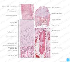 The end of a growing tibia, cut lengthwise*. Bone Histology Constituents And Types Kenhub