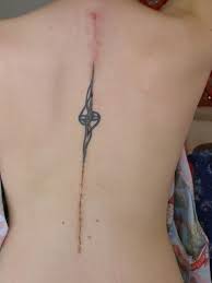 Spinal Fusion Surgery Scar By E Einbender Via Flickr Scar Tattoo Tattoo Over Scar Tattoos