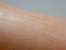 How To Fix A Self Tanning Accident The Natural Way Amazingy Magazine