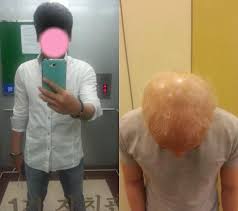 옛날 시골집에서 잘 때 특징. ìˆ± ë§Žë˜ ì¤'ë…„ ë°˜ë…„ ìƒˆ ëŒ€ë¨¸ë¦¬ í• ì•„ë²„ì§€ ëœ ì´ìœ ê°€ íƒˆëª¨ì¹˜ë£Œì£¼ì‚¬ ì•„ì£¼ê²½ì œ