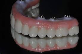 Most people can't make an easy decision among the various tooth replacement options. Zirconia Dental Implants Vs Titanium Implants Which Is The Best
