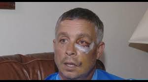 Disc golfer sucker punched at Morley Field