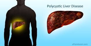 Pin On Abdominal Pain Or Stomach Pain