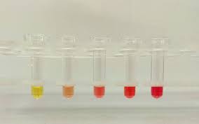 Hemolysis Wikipedia