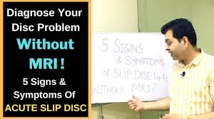 Slip disc exercise hindi mai. 5 Signs And Symptoms Of Slip Disc L4 L5 S1 Diagnose Slip Disc Without Mri Disc Prolapse Symptoms