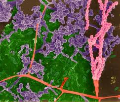 The bacteria form protective spores when conditions for survival are poor. Clostridium Botulinum Botulism Diagnosis Treatment And Information