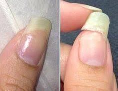 On laisse bien sécher puis on réitère lopération. 9 Idees De Ongles Casses Reparer Un Ongle Casse Ongles Ongle Casse
