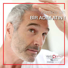 Dogal Gorunumlu Sonuclar Veren Profesyonel Sac Ekimi Icin Bizi Hemen Arayin 0530 182 4373 Https Anatoliasacekim Com Yelizdamar Anato Sac Sakal Biyiklar
