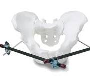 Large and Medium External Fixation System | Products | DePuy ...