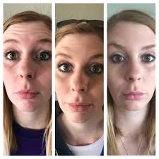 Are you intrigued about the new Botox and Dermal Filler services offered at  the salon?*** This is Katie from Younger Effects and I wanted to share my  personal Botox results. I had