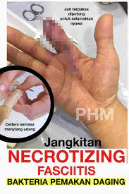 Yang lebih sering kasus pembullyan itu santri cowok. Public Health Malaysia Seorang Lelaki Terluka Jarinya Semasa Menyiang Udang Tidak Luka Teruk Pun Hanya Tercucuk Dan Berdarah Sedikit Ini Bukan Kali Pertama Dia Tercedera Ringan Semasa Menyiang Udang Ikan