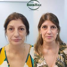 Fabio Faria (@bucomaxcirurgia) • Instagram फोटोहरू र भिडियोहरू