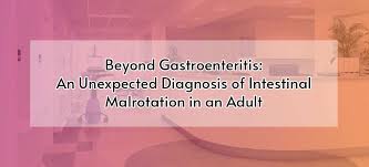 Image result for Intestinal Malrotation