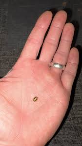 Looking bit of info, my previous Impreza was a ppp Impreza, it was too far  gone with rust so decided to break it for parts, knowing I was getting  another I kept