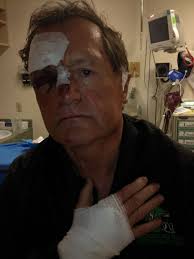 Former Roughrider Al Ford attacked outside Regina liquor store