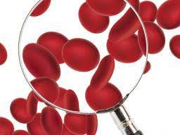 Low Red Blood Cell Count Symptoms Diet And Lifestyle Changes