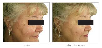 Ascii characters only (characters found on a standard us keyboard); Blog Buffalo Aesthetics