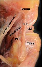 An fcl is commonly injured due to a blow to the inside of the knee. Acl And Posterolateral Corner Injuries Abstract Europe Pmc