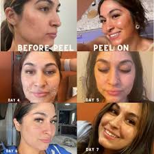 RENEW MED SPA & CRYOTHERAPY