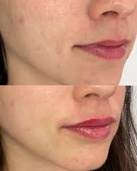 💋Filler Friday💋. This...