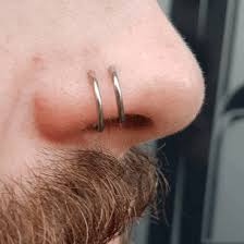 Using a sea salt solution is one of the ways to get rid of a keloid on nose piercing. High Quality Part 12 Lumps And Bumps Rogue Piercing