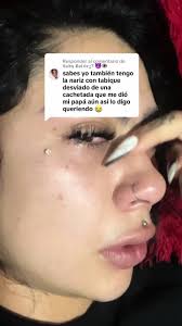 Respuesta a @𝕷𝖆𝖉𝖞 𝕾𝖔𝖑ó𝖗𝖟? 👿👁️ Hay heridas que no sanan💔 lamento  saber que tantas personas pasan por cosas tan dolorosas, hoy en  @Plasma_Bogota me ayudaron con mi nariz, este lugar es increíble y me ...