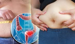 Frequently patients with stomach cancer report feeling overly satiated or full after consuming small meals. Stomach Bloating Could Be Symptom Of Ovarian Bowel Or Stomach Cancer Express Co Uk