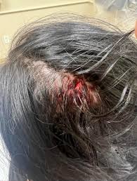 Deja Vu on X: After submitting evidence my detective has decided to move  forward with pressing charges against my abuser. I am done protecting  Tanner Kasten for what he did to me.