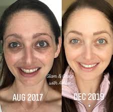 What are the benefits of using Doterra skin care products?