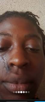 Does vitamin e stain or bleed through clothes?