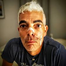 James Lambert, also known as Frenchy, is someone who exudes positivity. His  life before cancer was centered