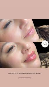 Hudson Valley Beauty Lab And Medi Spa In Newburgh NY