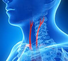 Image result for carotid artery