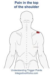Pin On Remedies