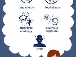Urticaria Hives Causes And Risk Factors