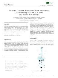 Direttamente dalla sede facebook di dublino, virginia si occupa di sviluppare piccole e medie realtà del mercato italiano. Pdf Early And Complete Response Of Bone Metastases Documented By Fdg Pet Ct Scan In A Patient With Nsclc