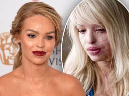 Katie Piper reveals that the movie biopic about her horrific acid attack  will be 'dark'