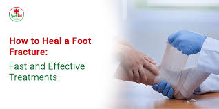 Image result for Foot Fracture